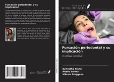 Buchcover von Furcación periodontal y su implicación