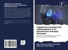 Capa do livro de Сердечно-сосудистые заболевания и их различные методы лечения 