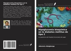 Bookcover of Hipoglucemia bioquímica en la diabetes mellitus de tipo 2