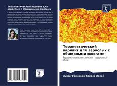 Bookcover of Терапевтический вариант для взрослых с обширными ожогами
