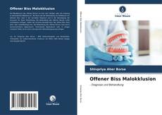 Bookcover of Offener Biss Malokklusion