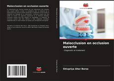 Bookcover of Malocclusion en occlusion ouverte