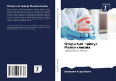 Bookcover of Открытый прикус Малокклюзия