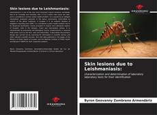 Buchcover von Skin lesions due to Leishmaniasis: