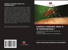 Buchcover von Lésions cutanées dues à la leishmaniose :