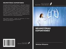 Bookcover of NEUMOTÓRAX ESPONTÁNEO
