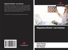 Hepatocellular carcinoma kitap kapağı