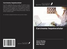 Buchcover von Carcinoma hepatocelular
