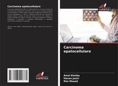 Carcinoma epatocellulare kitap kapağı