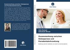 Capa do livro de Zusammenhang zwischen Osteoporose und Parodontalerkrankung 