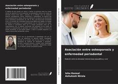 Bookcover of Asociación entre osteoporosis y enfermedad periodontal