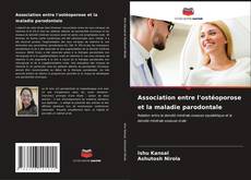 Bookcover of Association entre l'ostéoporose et la maladie parodontale