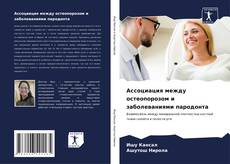 Buchcover von Ассоциация между остеопорозом и заболеваниями пародонта