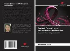 Capa do livro de Breast Cancer and Antinuclear Antibodies 