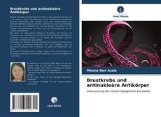 Buchcover von Brustkrebs und antinukleäre Antikörper