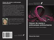 Cáncer de mama y anticuerpos antinucleares kitap kapağı