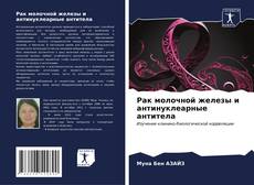 Bookcover of Рак молочной железы и антинуклеарные антитела