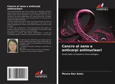 Buchcover von Cancro al seno e anticorpi antinucleari