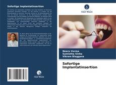 Sofortige Implantatinsertion kitap kapağı