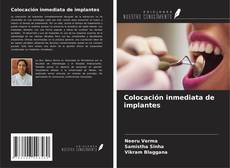 Colocación inmediata de implantes kitap kapağı