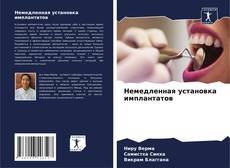 Bookcover of Немедленная установка имплантатов