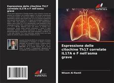Portada del libro de Espressione delle citochine Th17 correlate IL17A e F nell'asma grave