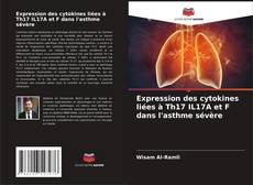 Buchcover von Expression des cytokines liées à Th17 IL17A et F dans l'asthme sévère