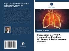 Couverture de Expression der Th17-verwandten Zytokine IL17A und F bei schwerem Asthma