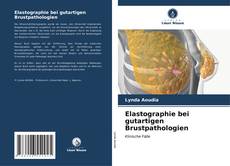 Elastographie bei gutartigen Brustpathologien kitap kapağı