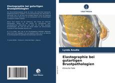 Borítókép a  Elastographie bei gutartigen Brustpathologien - hoz