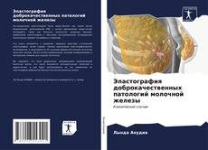 Capa do livro de Эластография доброкачественных патологий молочной железы 
