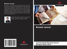 Bookcover of Breast cancer