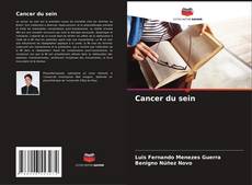 Bookcover of Cancer du sein