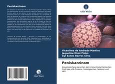Bookcover of Peniskarzinom