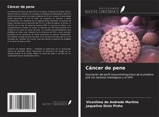 Buchcover von Cáncer de pene