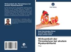 Bookcover of Wirksamkeit der Thrombolyse bei akutem Myokardinfarkt