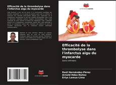 Capa do livro de Efficacité de la thrombolyse dans l'infarctus aigu du myocarde 