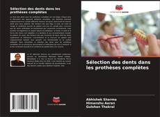 Bookcover of Sélection des dents dans les prothèses complètes