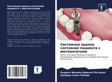 Bookcover of Системная оценка состояния пациента с имплантатами