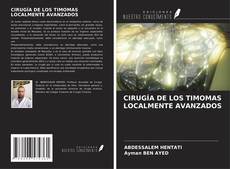 Copertina di CIRUGÍA DE LOS TIMOMAS LOCALMENTE AVANZADOS