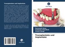 Capa do livro de Transplantate und Implantate 