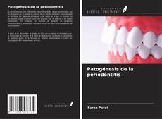 Portada del libro de Patogénesis de la periodontitis