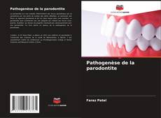 Pathogenèse de la parodontite的封面