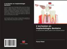 Buchcover von L'occlusion en implantologie dentaire