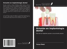 Portada del libro de Oclusión en implantología dental
