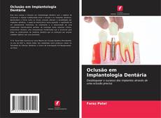 Portada del libro de Oclusão em Implantologia Dentária