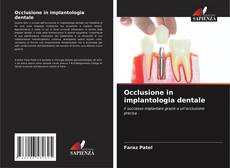 Couverture de Occlusione in implantologia dentale