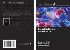 Capa do livro de Biopelículas en endodoncia 