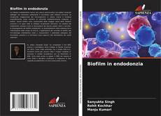 Biofilm in endodonzia的封面
