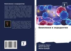 Buchcover von Биопленки в эндодонтии